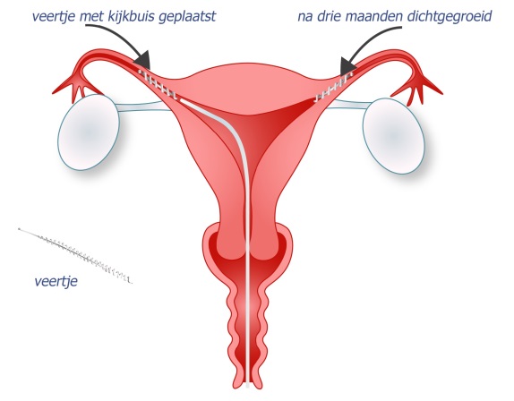 hormonen bij vrouwen