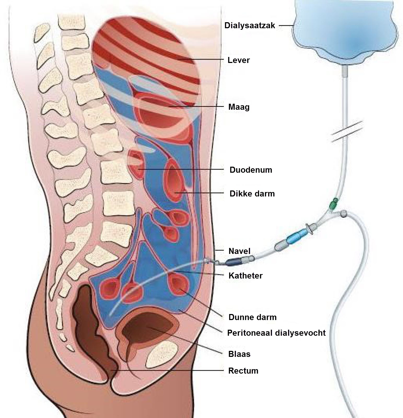 Peritoneaal dialyse spoelvloeistof