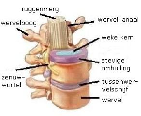 Slingeland Ziekenhuis Pati Ntfolder Nekhernia Operatie